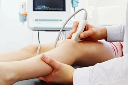 dr. alexandre zoppi ultrassom com doppler colorido venoso de membros inferiores